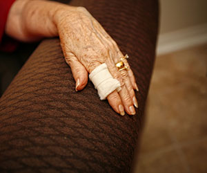 elder abuse - Hand Injury