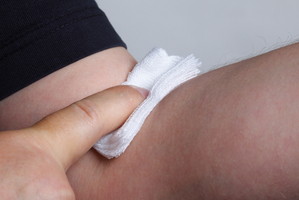 blood test - Arm