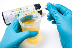 Los Angeles DUI Urine Testing